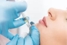 Çene Dolgusunu Kimler Yaptırabilir.webp