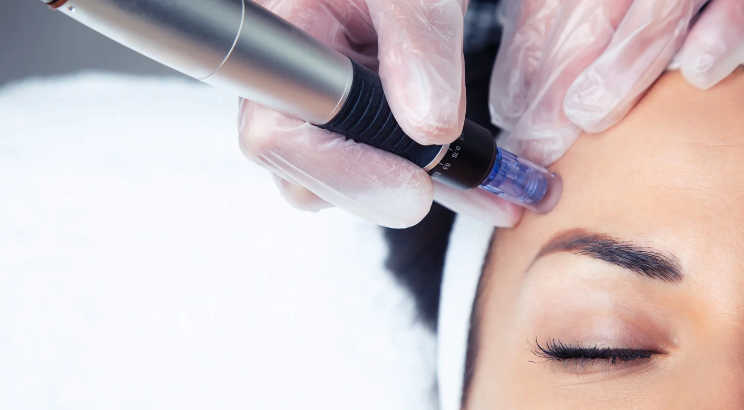 Dermapen Sonrası Cilt Bakımı Nasıl Yapılır.webp