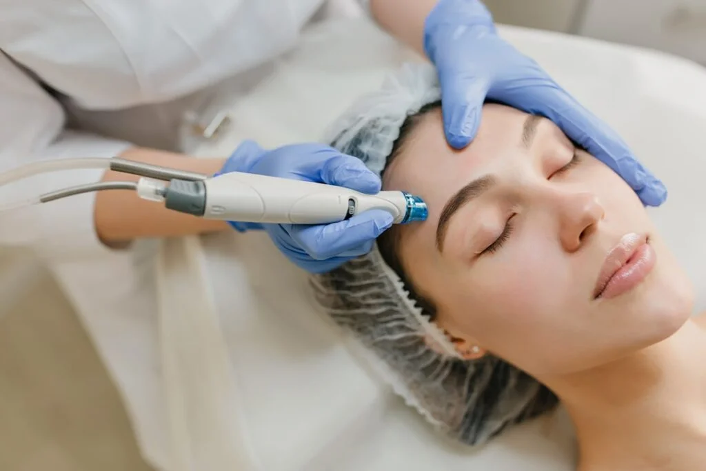 Dermapen Sonrası Soyulma Kaç Gün Sürer.webp