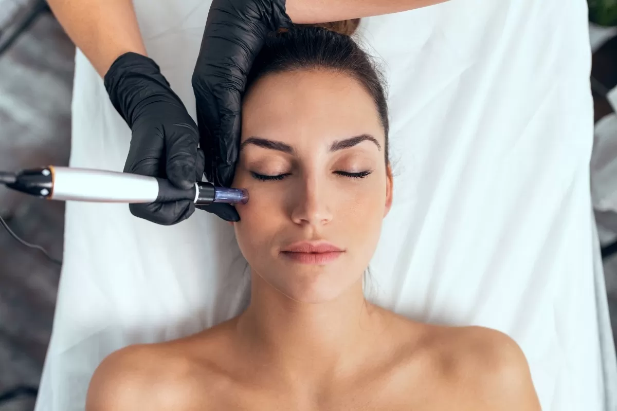Dermapen Sonrası Yüz Ne Zaman Yıkanır.webp