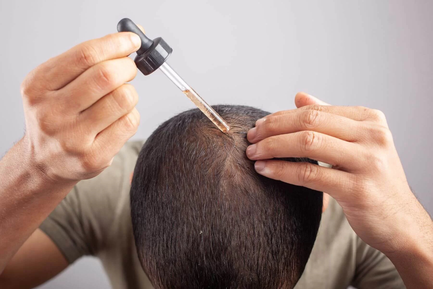 Evde Kendi Minoxidil Solüsyonunuzu Hazırlayın.jpg