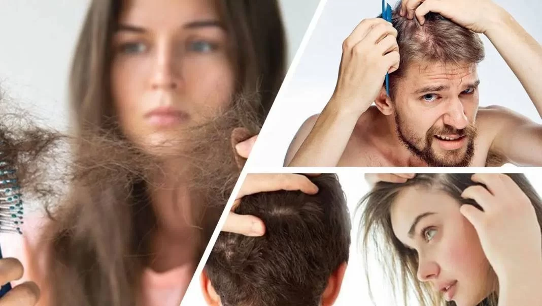 Saç Dökülmesinin Nedenleri Nelerdir? Önleme Yolları Nelerdir?