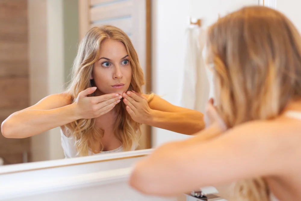Sivilce Neden Çıkar? Hormonal mi Yoksa Beslenmeden mi?.webp