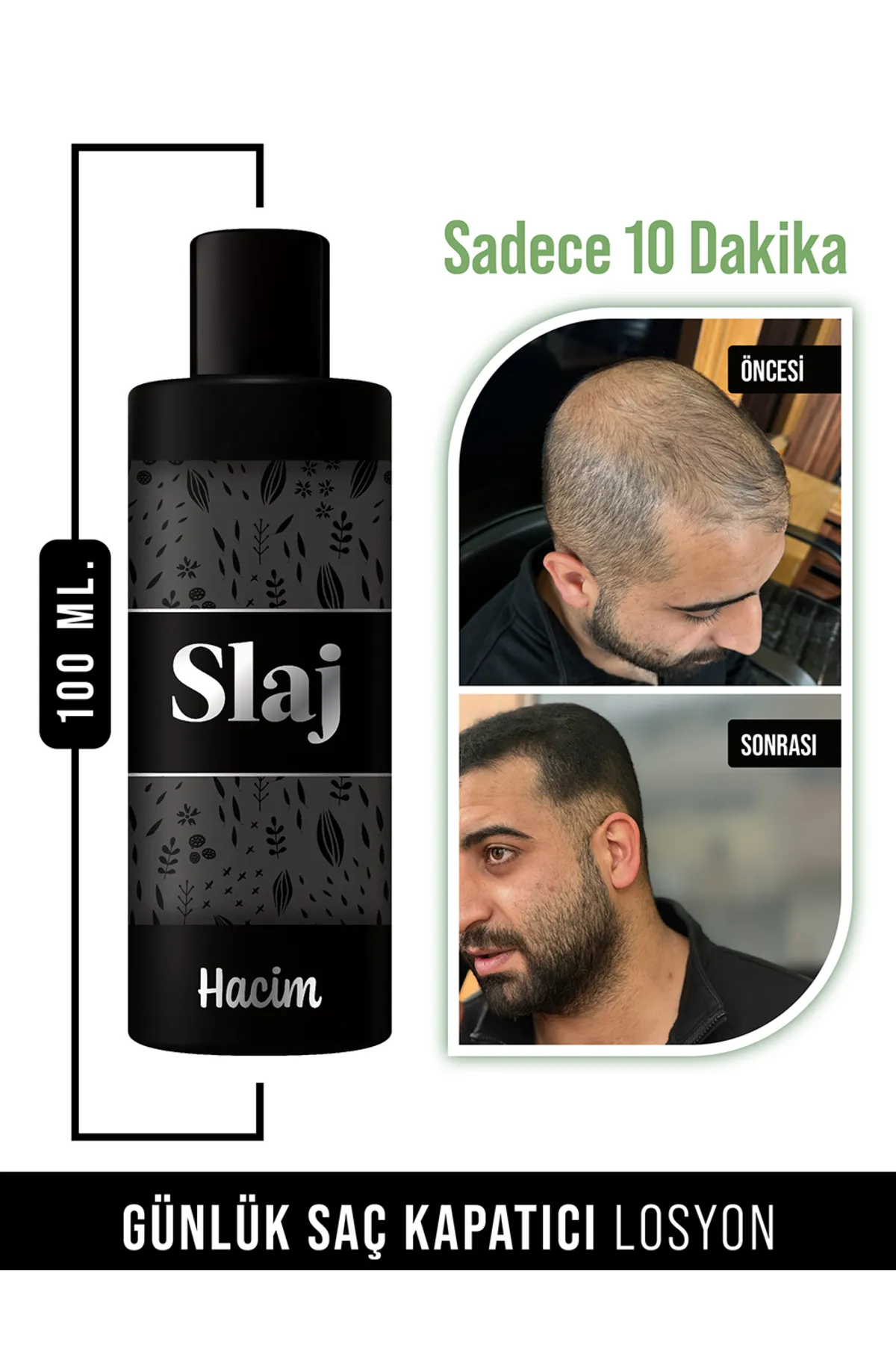 Slaj Seyrek Saç Kapatıcı Sıvı Topik.WEBP