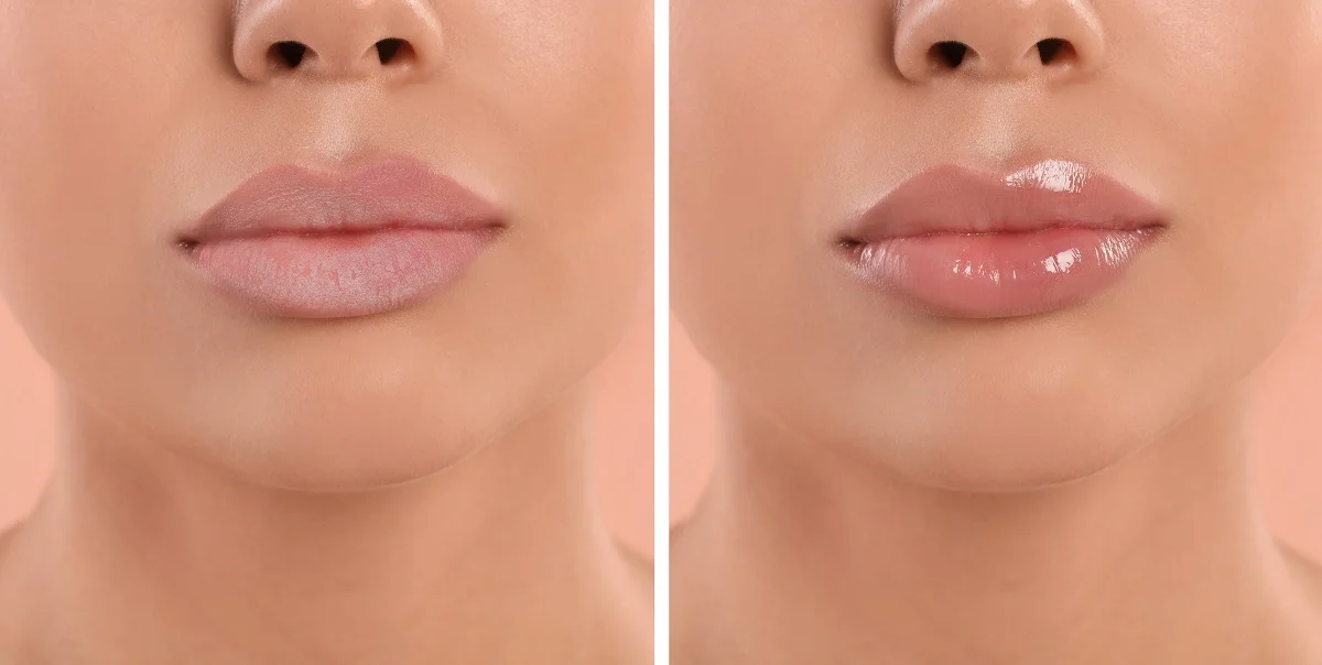 Lip Flip Mi Glossy Volume Dudak Dolgusu.webp