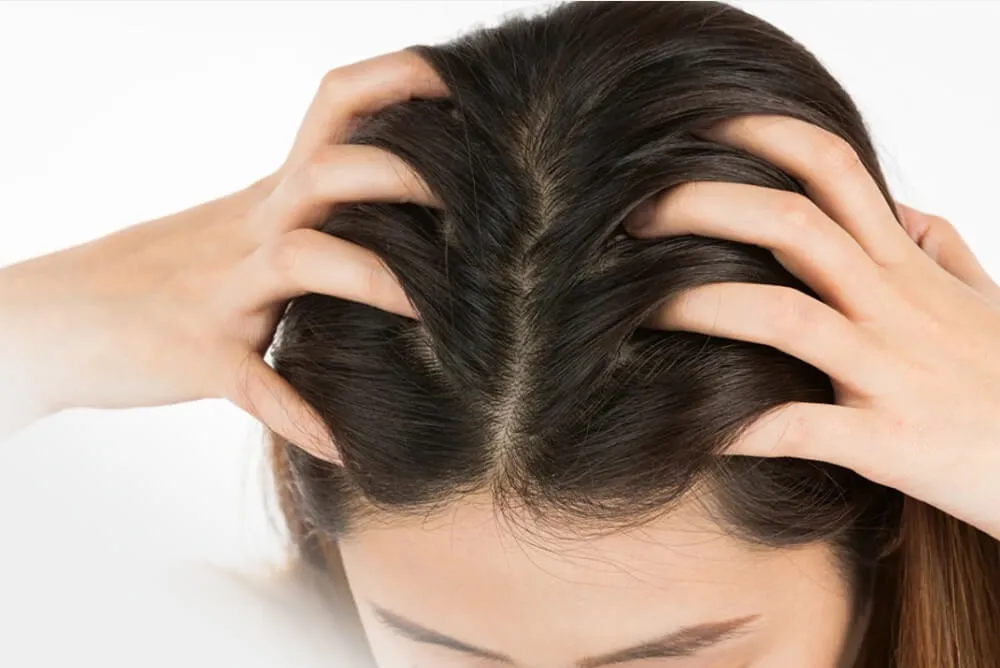 Saç Derisi (Scalp) Mikrobiyomu 2025’te Sağlıklı Saçın Sırrı.webp
